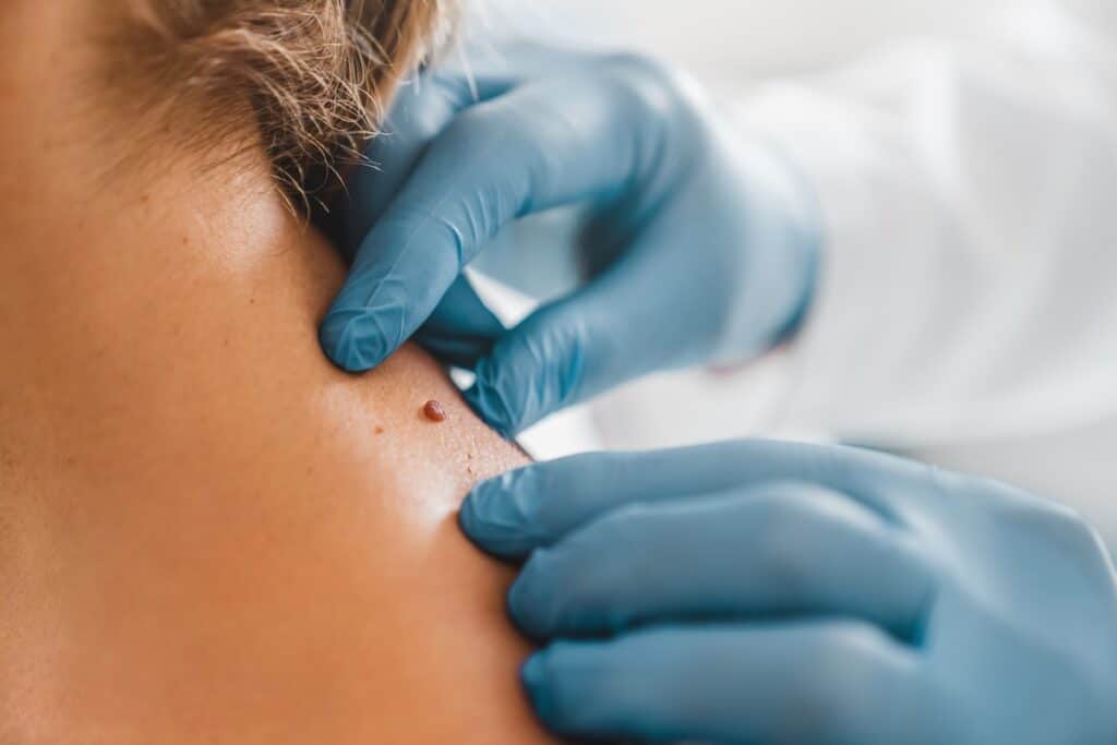 Un dermatologue gagne entre 3 000 et 40 000 € par mois